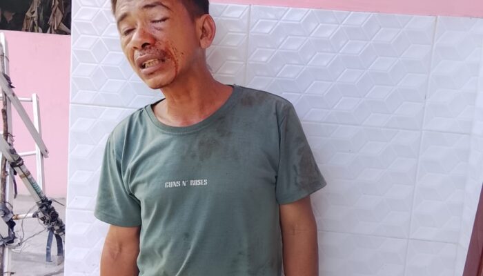 Warga Paya Gambar Diduga Dianiaya Sekelompok Pemuda, GRPK Desak Polisi Usut Dugaan Main Hakim Sendiri
